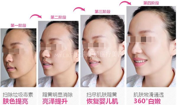 给还在犹豫要不要美白的你