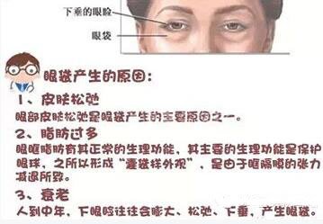 想要永葆青春,显老的眼袋必须割