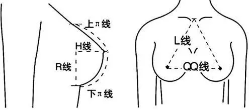 自体脂肪移植填充丰胸 做“挺”好女人