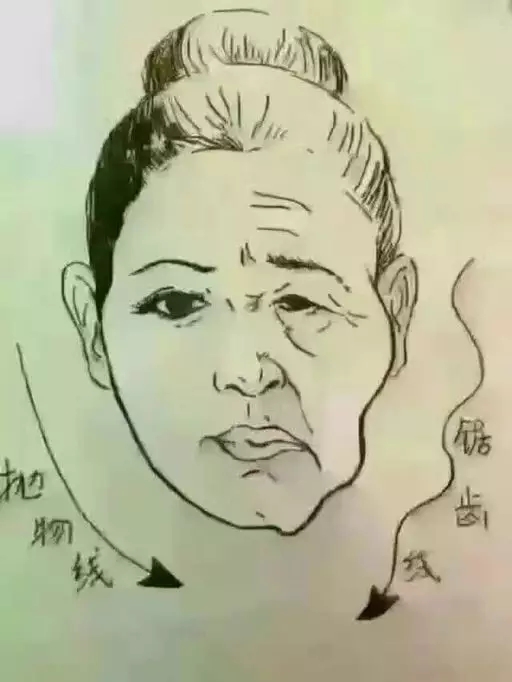 线雕提升除皱的优势是什么