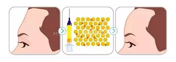 微整形,专治面部五官各种“不服”