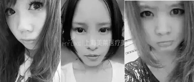 鼻梁翘，颜值爆！