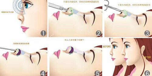 鼻梁翘，颜值爆！