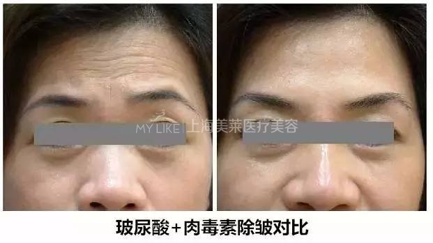 有一种美丽叫:抬头不见抬头纹,低头不见双下巴!