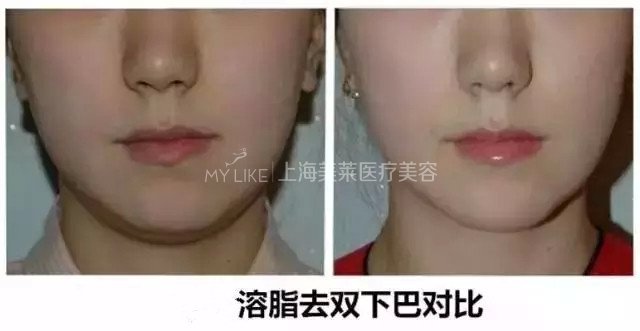 有一种美丽叫:抬头不见抬头纹,低头不见双下巴!